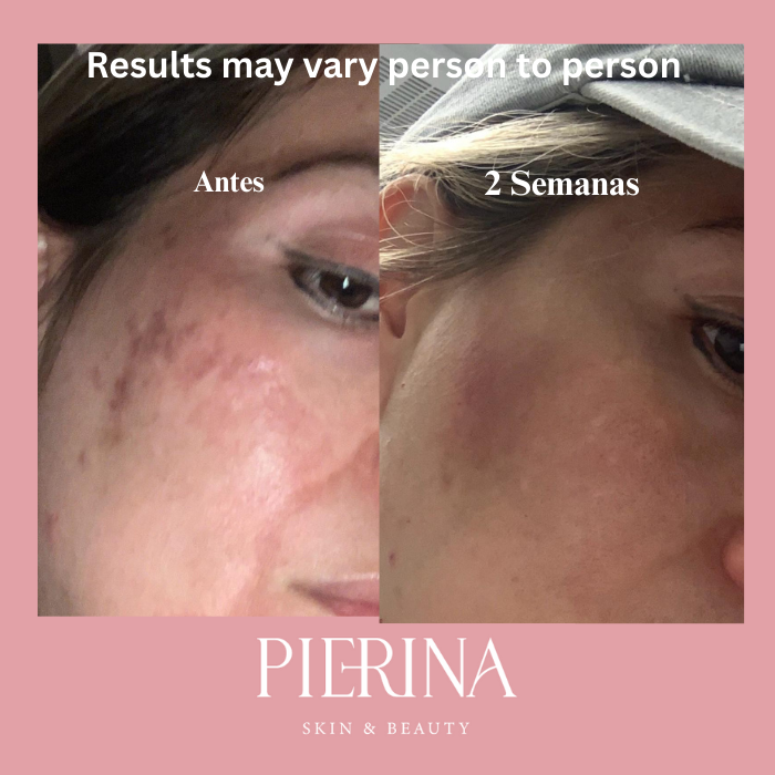 Anti-Melasma Even Skin System
