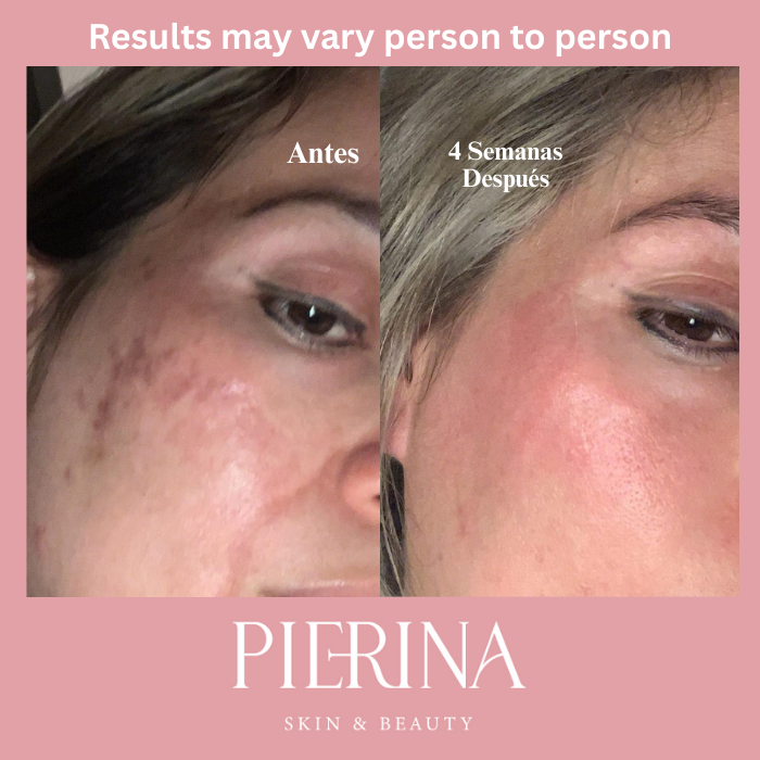 Anti-Melasma Even Skin System